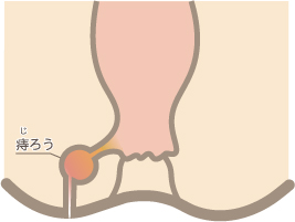 痔ろう